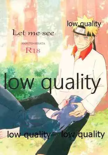 (Zennin Shuuketsu 2) [strikeparty (Izumi)] Kanata no omoi wa ryoute ni tokeru (NARUTO) [Chinese] [沒有漢化]